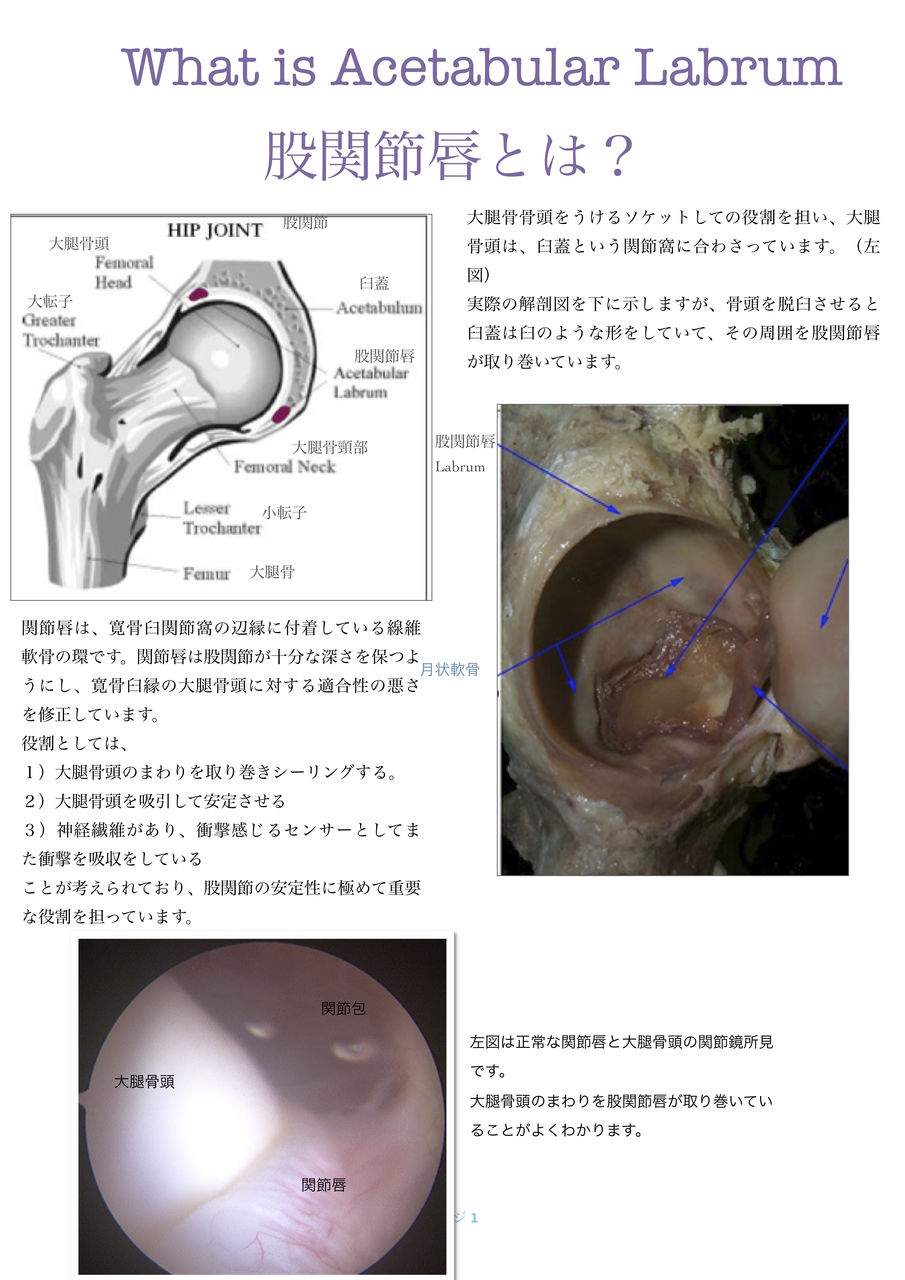 股関節唇とは What is acetabular labrum?のパンフレットでき 股関節唇とは What is acetabular labrum?のパンフレットでき