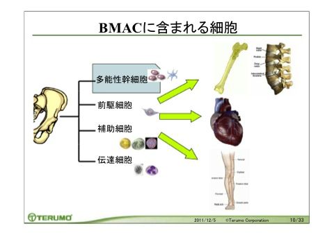 軟骨損傷や変形性関節症への未来に治療 骨髄由来幹細胞 BMAC