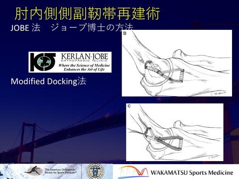 Jobe method docking method