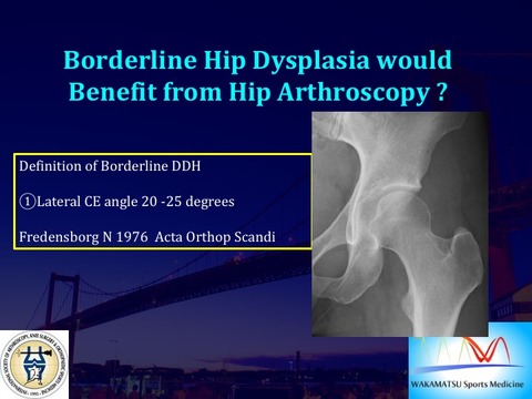 BDDH definition