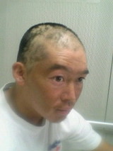 淳脱毛開始2