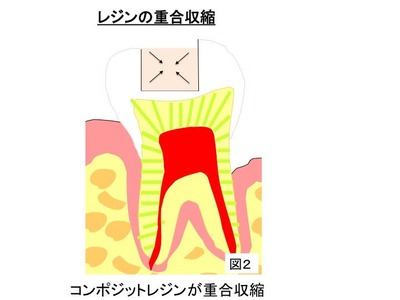 CR図2