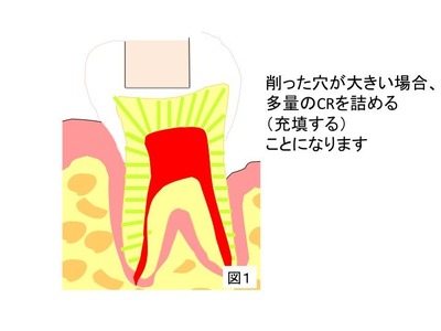 CR図1