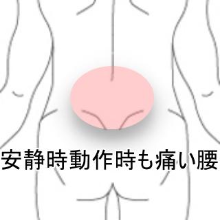 痛い腰