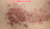 20日目 背中