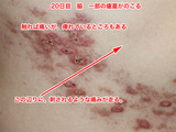 20日脇