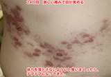 24日目 腹