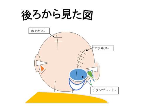 キャプチャ