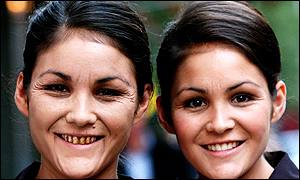 twins_b300