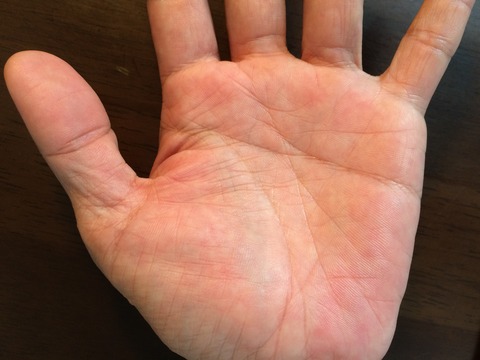52