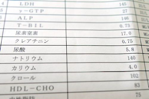 尿酸値 尿酸値