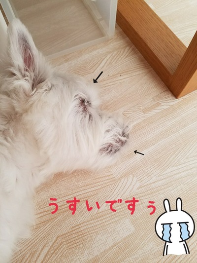 アトピー