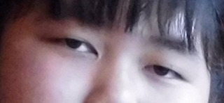 眼科受診のおすすめ3