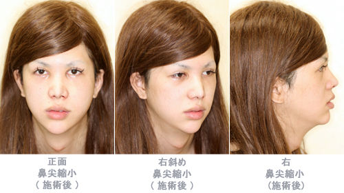 03-after
