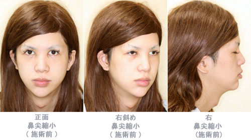 02-before