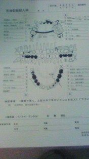 チャート