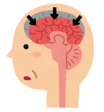 sick_ninchisyou_alzheimer
