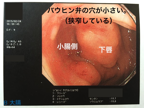 IMG_1939_20150224_開設