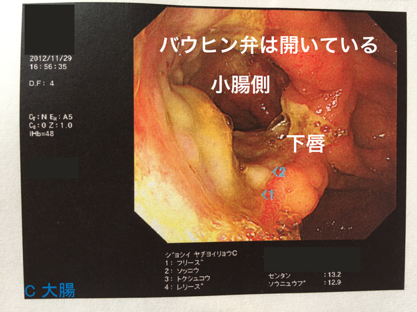 IMG_1971_20121129_開設