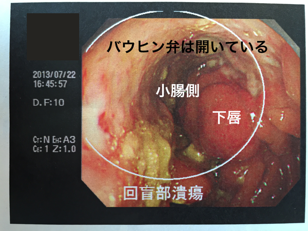 IMG_1958_20130722_開設