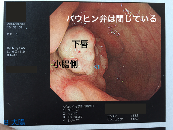 IMG_2006_20140430_開設