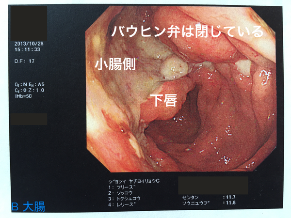IMG_1989_20131028_開設