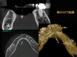 ���Ф�CT����