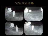 遠藤3
