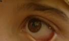 girl_has_crystals_coming_out_of_eyes