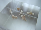Revyの歯