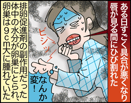 排卵促進剤2