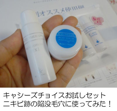 キャシーズチョイスお試しセット ニキビ跡の陥没毛穴への効果検証!