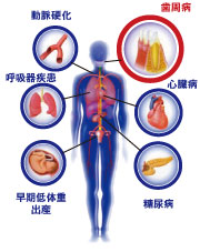 歯周病と身体