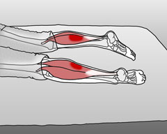 symptoms-calf