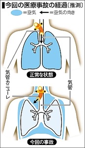 2012031799085505