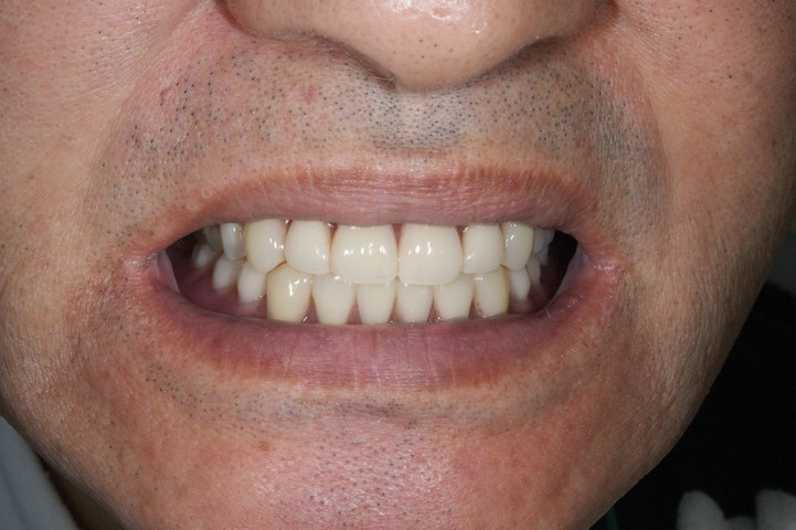 DSC05575