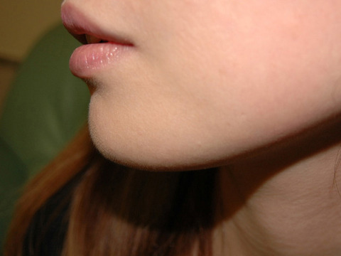 photo-003_012
