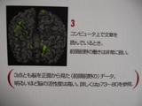 脳３