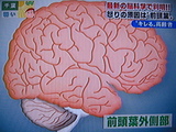 脳
