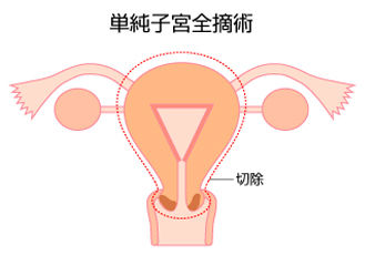 子宮を全摘した私に「こんな足手まといな体になったら普通は自分から身を引くもんだ」と言ってくれたトメが大腸がんの手術をしたので（ｒｙ