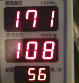 結婚して６年経ったら血圧が190近くまで上昇。元栄養士の嫁にそう話したら「幼少期からの食事が原因！私のせいじゃない！」と聞かない