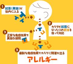 アレルギー
