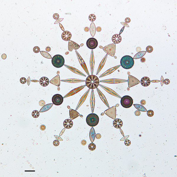 diatom-5