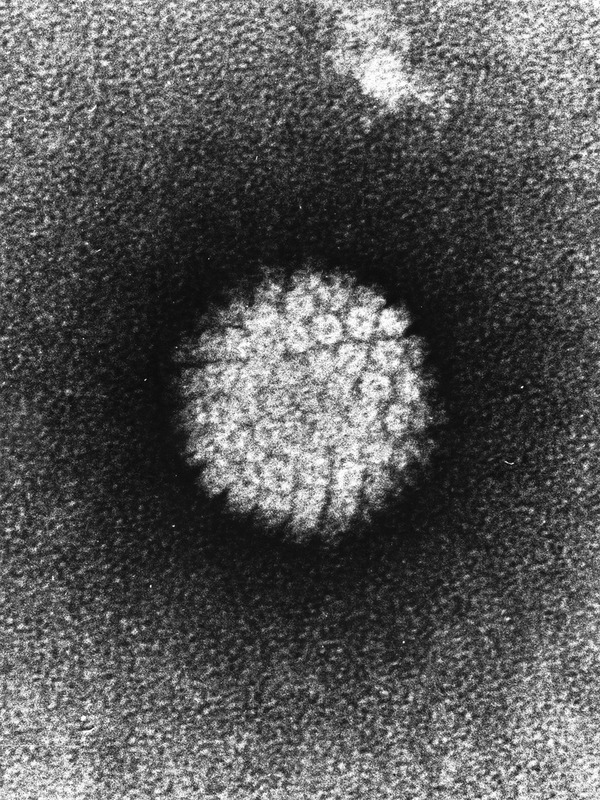 Papilloma_Virus_(HPV)_EM
