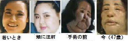 整形
