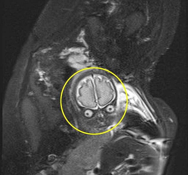 妊娠中の女性 MRIに写った赤ちゃんを見て大パニックに・・・
