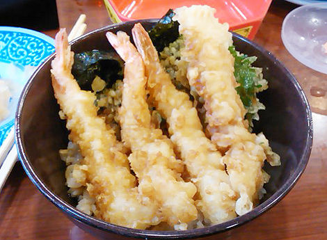 tendon001