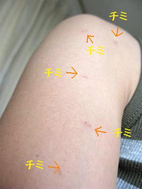 愛の チミ噛み やまねずみぶろぐ