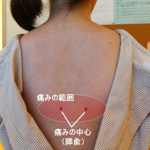 このツボ 背中の痛みに陽関 妊娠中でもｏｋ 鍼灸師のツボ日記