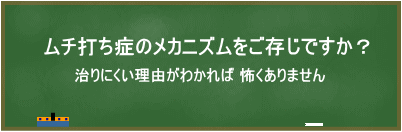 ムチ打ち症のメカニズム